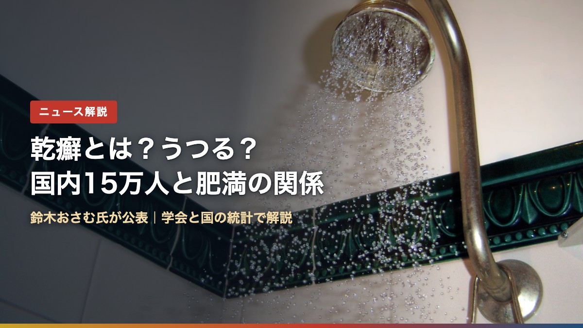 浴室のシャワー（乾癬とは？うつる？国内15万人と肥満の関係）